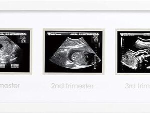 Trimester Progression Sonogram Picture Frame